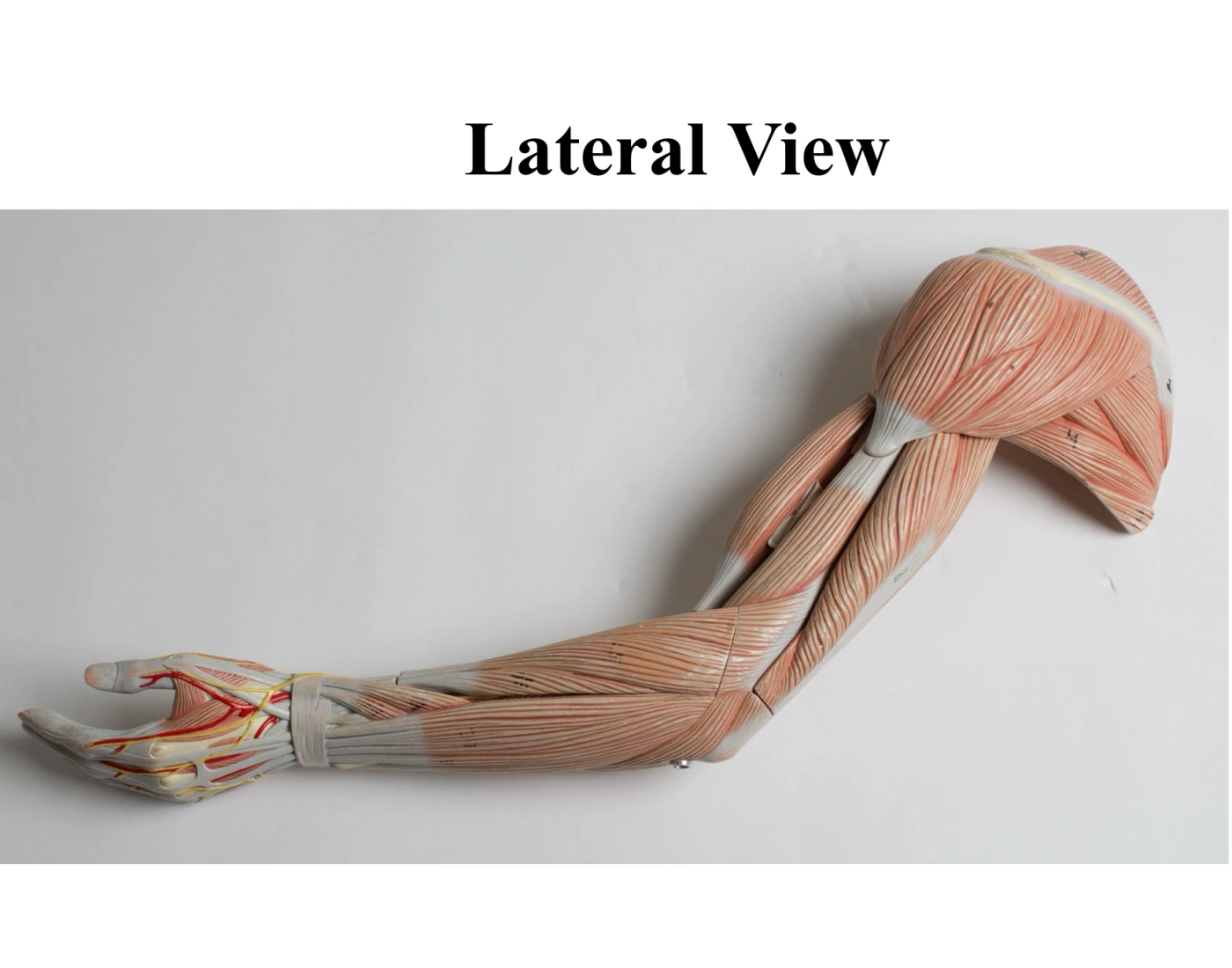 Lè arm lateral view Quiz