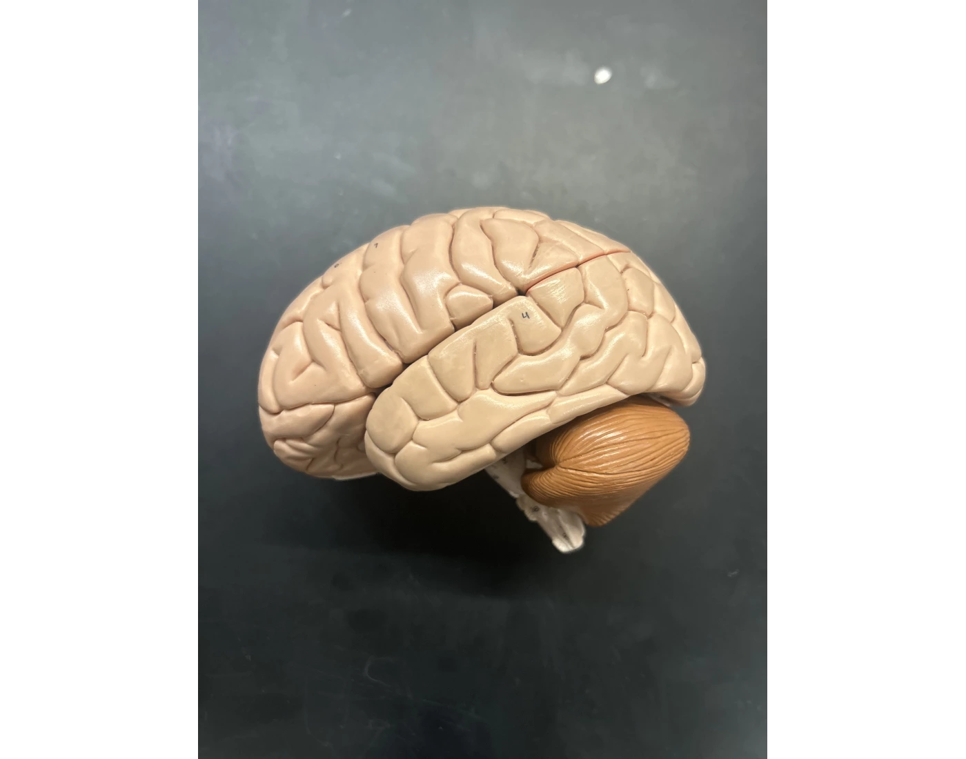 Anatomy of Lateral Brain Quiz