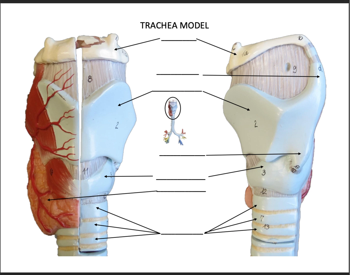 Trachea Model Labels Trachea Model Quiz