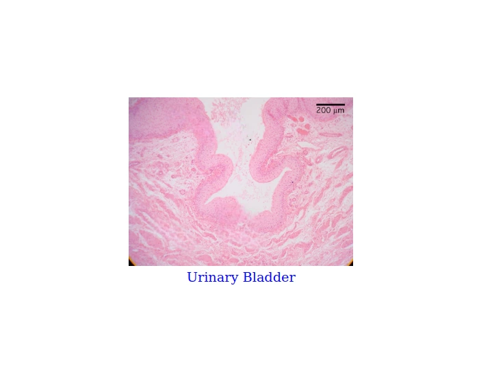 Bladder Game Urinary Bladder Quiz