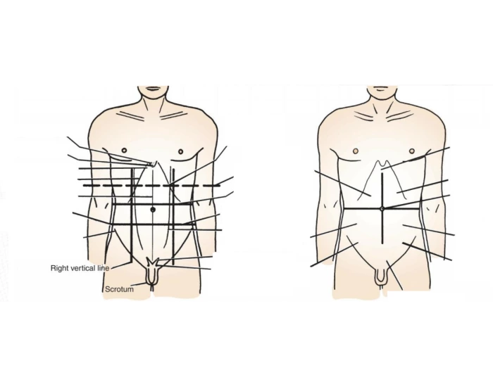 ABDOMEN OVERVIEW — Printable Worksheet ABDOMEN OVERVIEW — Printable Worksheet