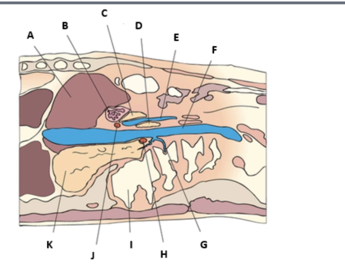 Coronal Abdomen Printable Worksheet