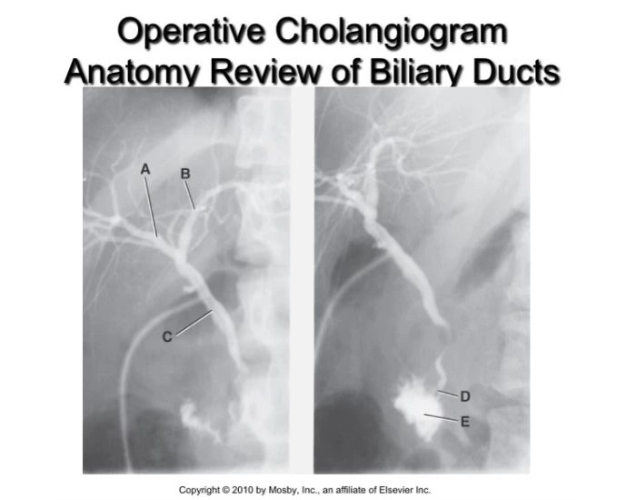 Operative cholangiogram anatomy — Printable Worksheet
