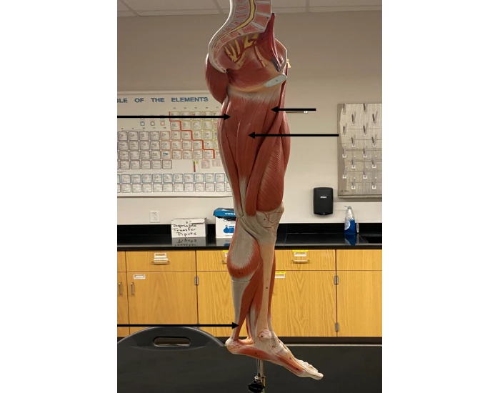 Muscle Practical #13 muscle practical Quiz