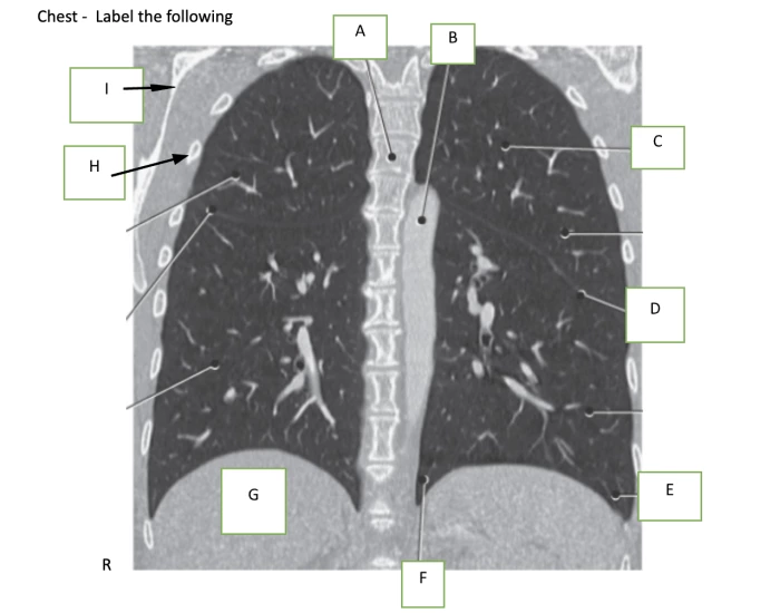 Bone Labelling Chest Chest Labeling — Printable Worksheet