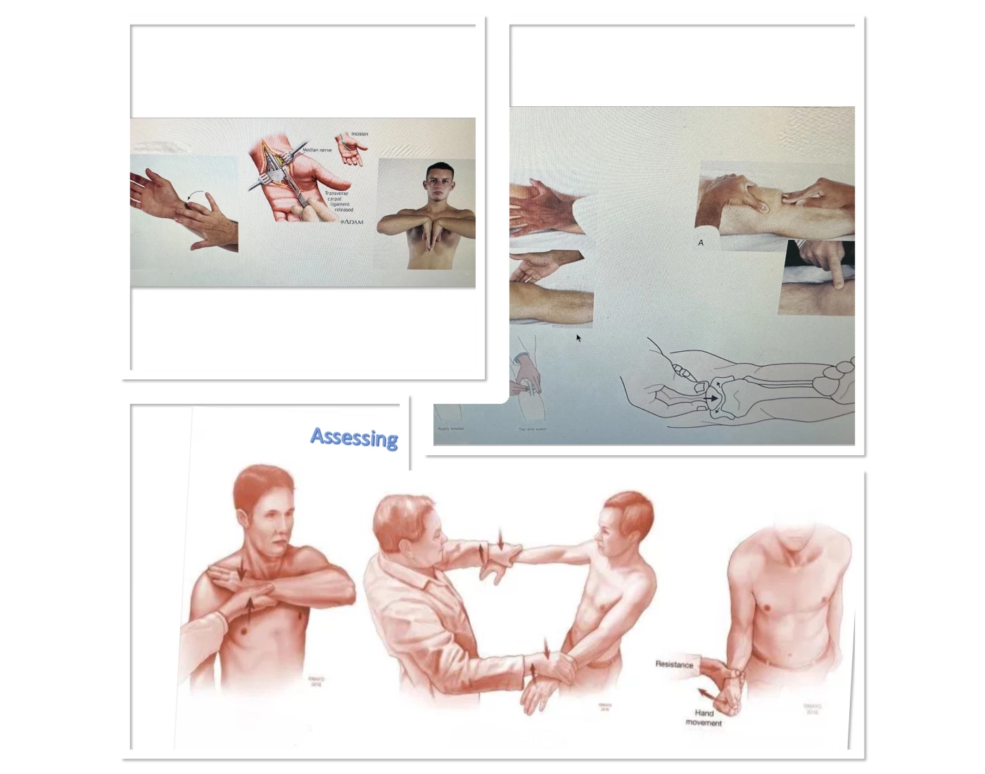 Left Hand Msk MSK images Quiz