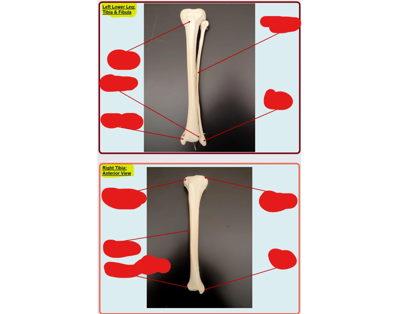 Lower Leg Bones Tibia and Fibula — Printable Worksheet