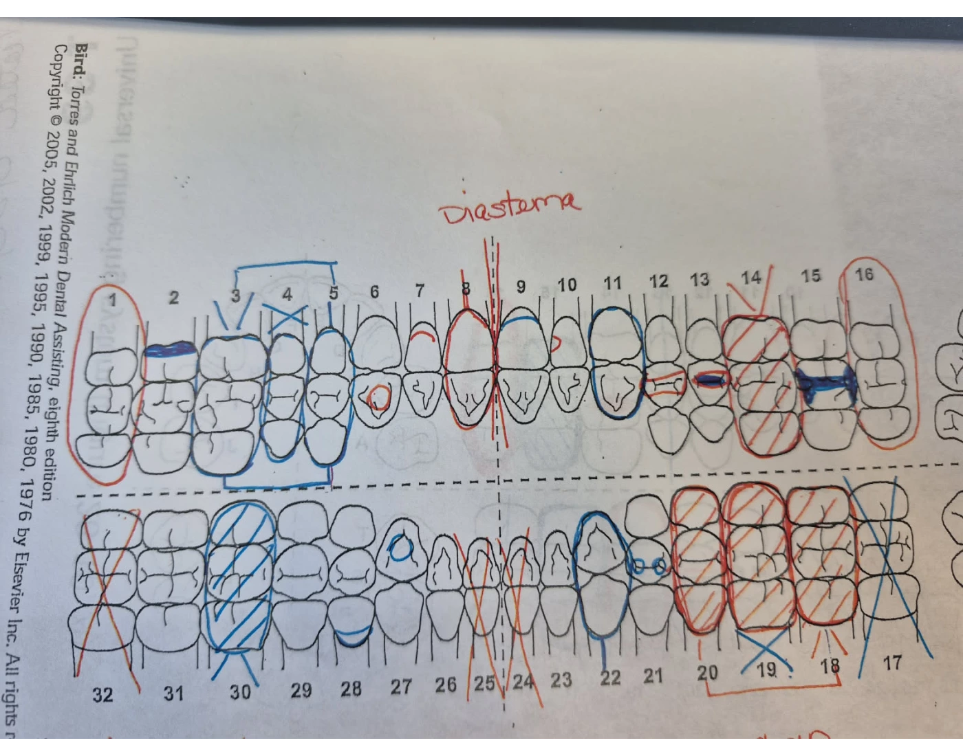 Dental Charting Quiz Dental charting quiz