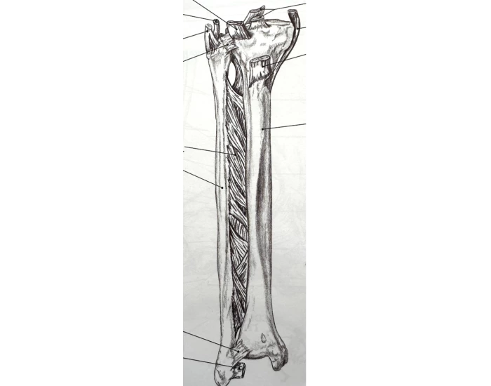 Anterior view of right tibia & fibula — Printable Worksheet