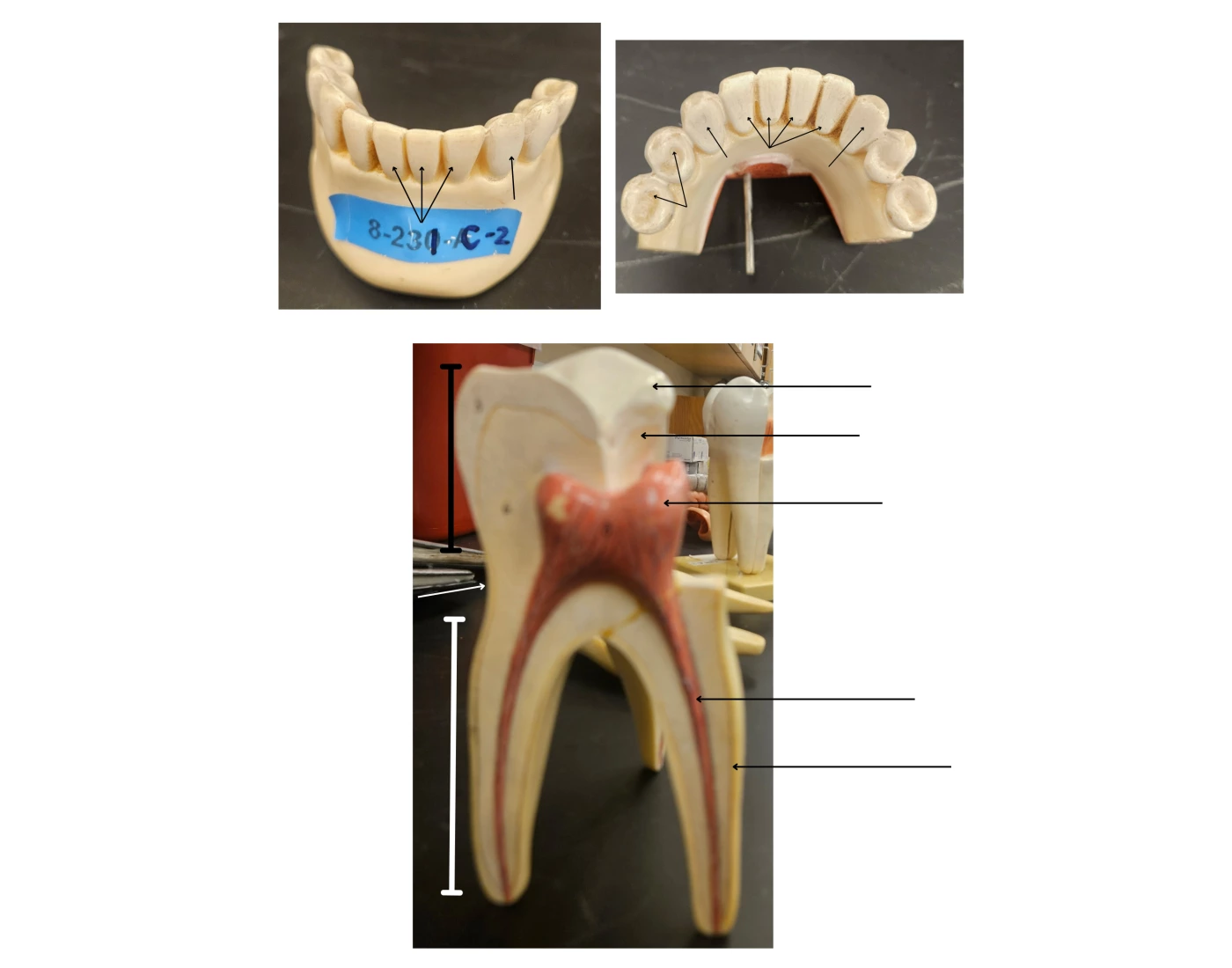 Module 1 11 Teeth Teeth Quiz