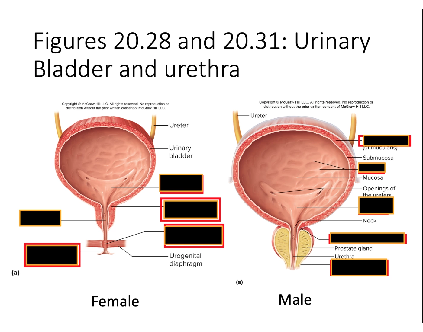 Bladder Game Urinary Bladder Quiz