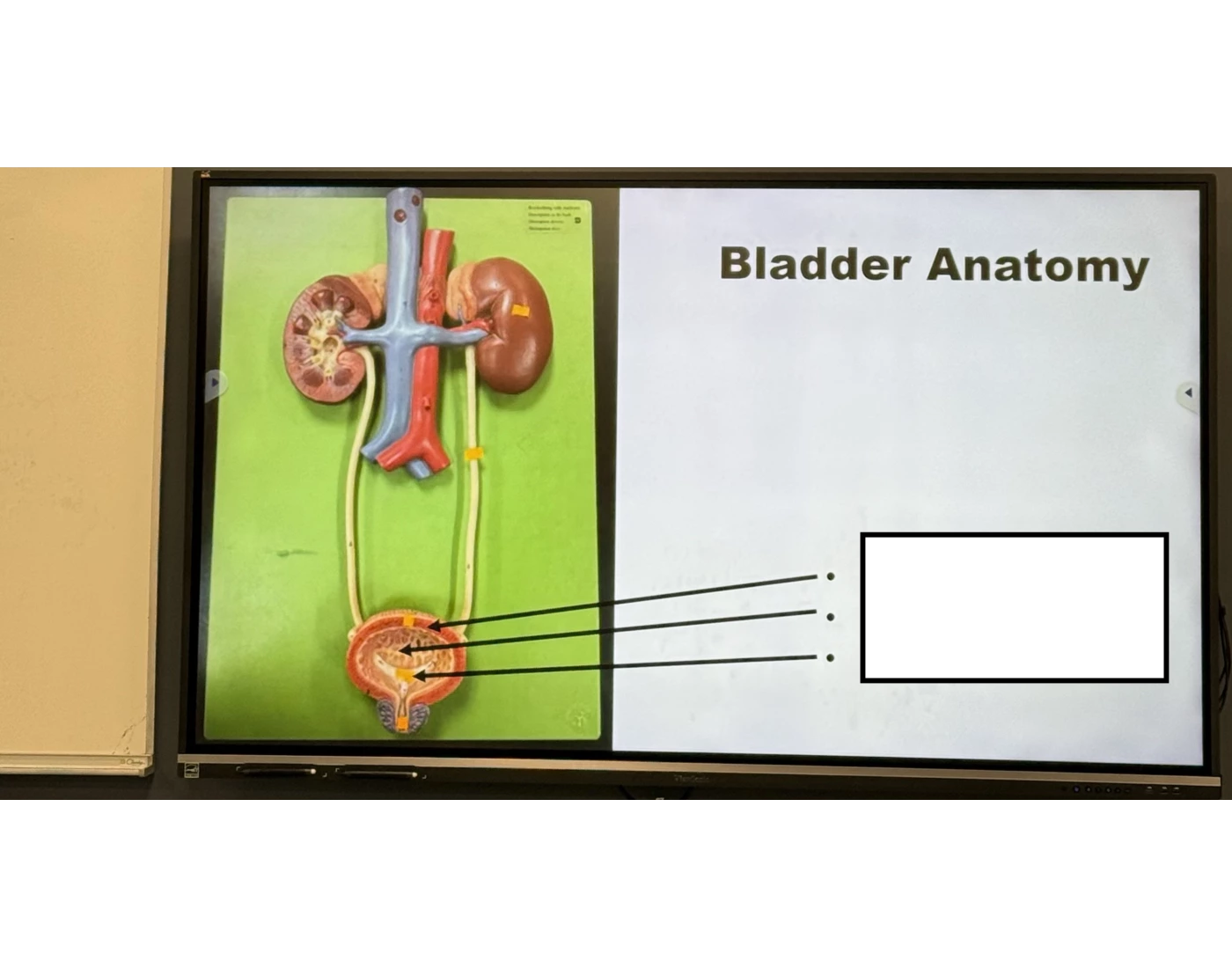 Bladder Game bladder anatomy Quiz