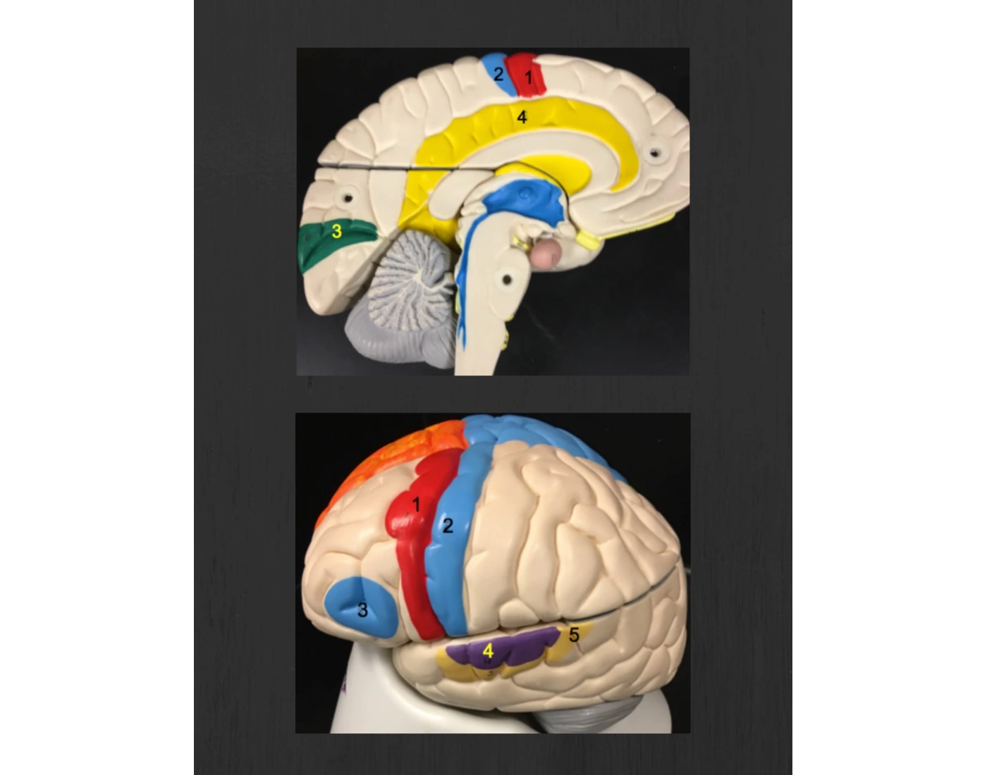 Bio Brain Bio 67A Lab - Exam 4 - Functional Brain Model Quiz