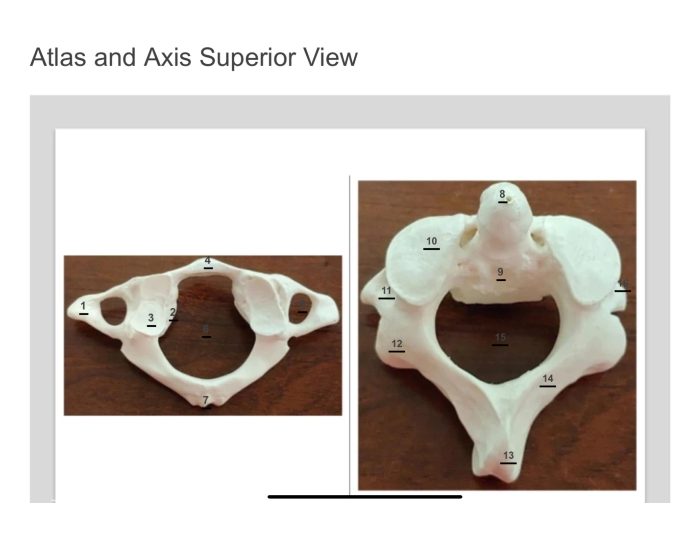 Axis/atlas — Printable Worksheet
