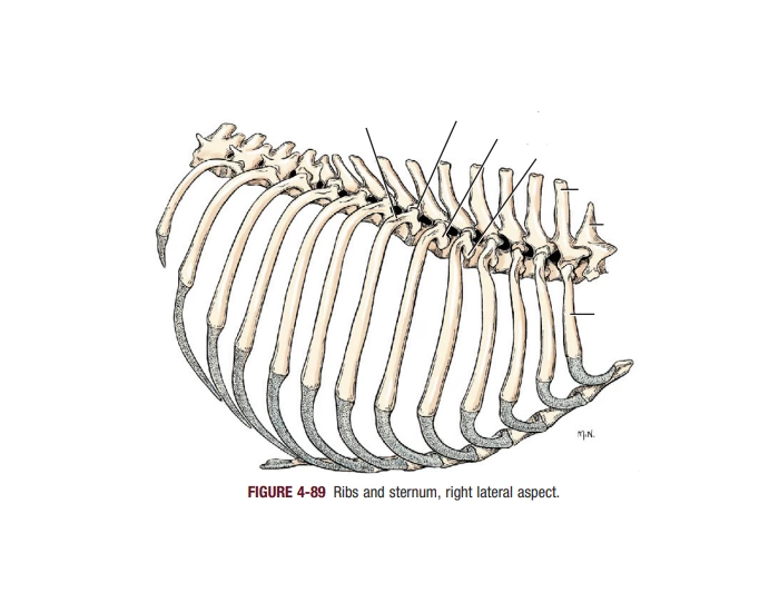 Ribs & Sternum R. Lateral Aspect — Printable Worksheet