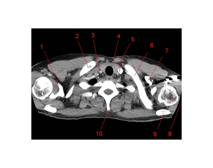 Ct Scan Worksheet.pdf Chest CT Axial Labeling 1 — Printable Worksheet