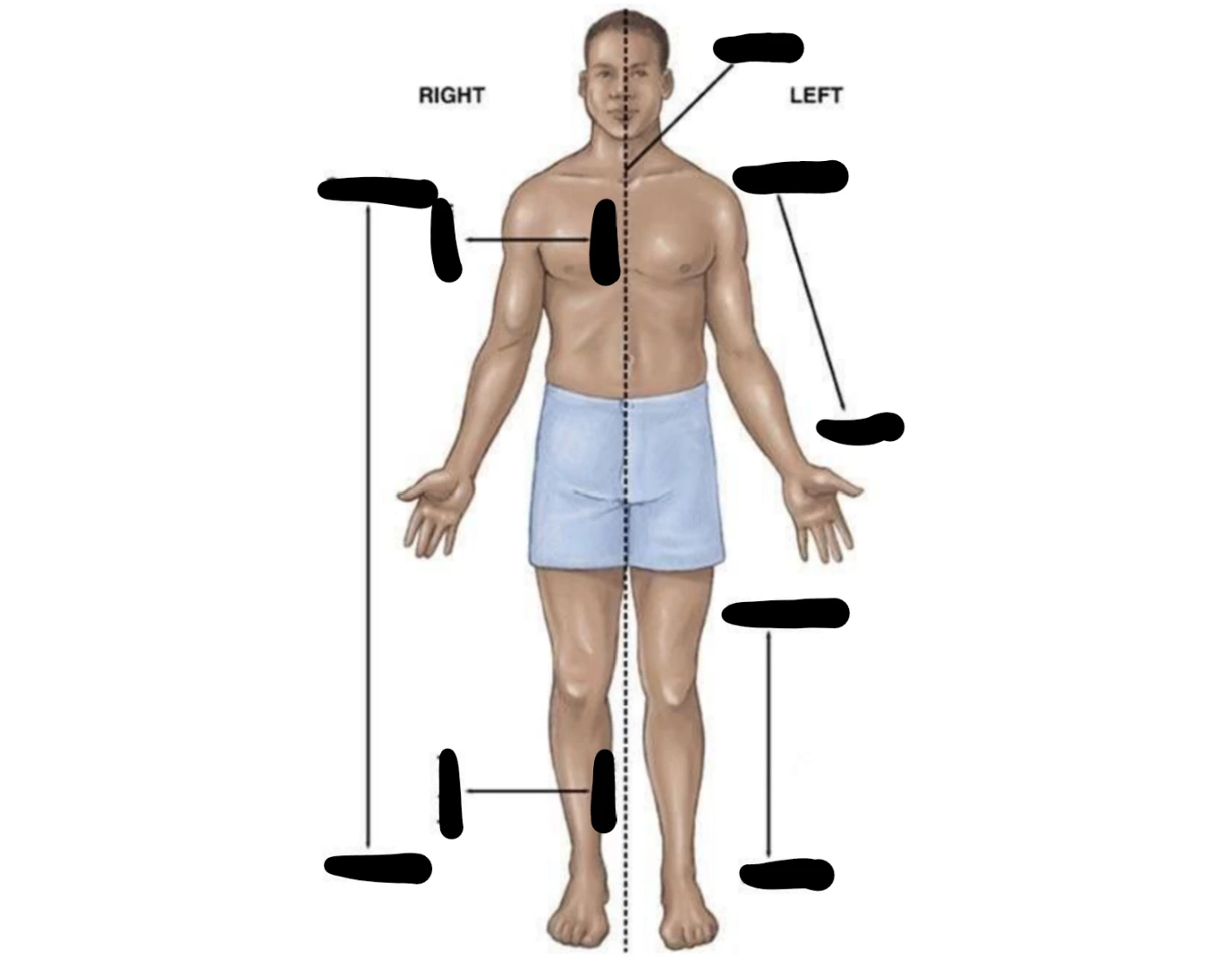 anatomical position Quiz