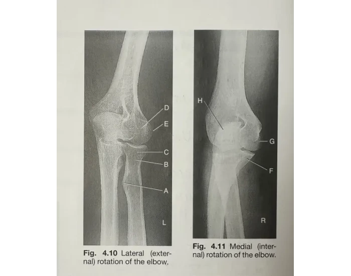Elbow Extneral Rotation Lateral and Medial Rotation of the Elbow Quiz