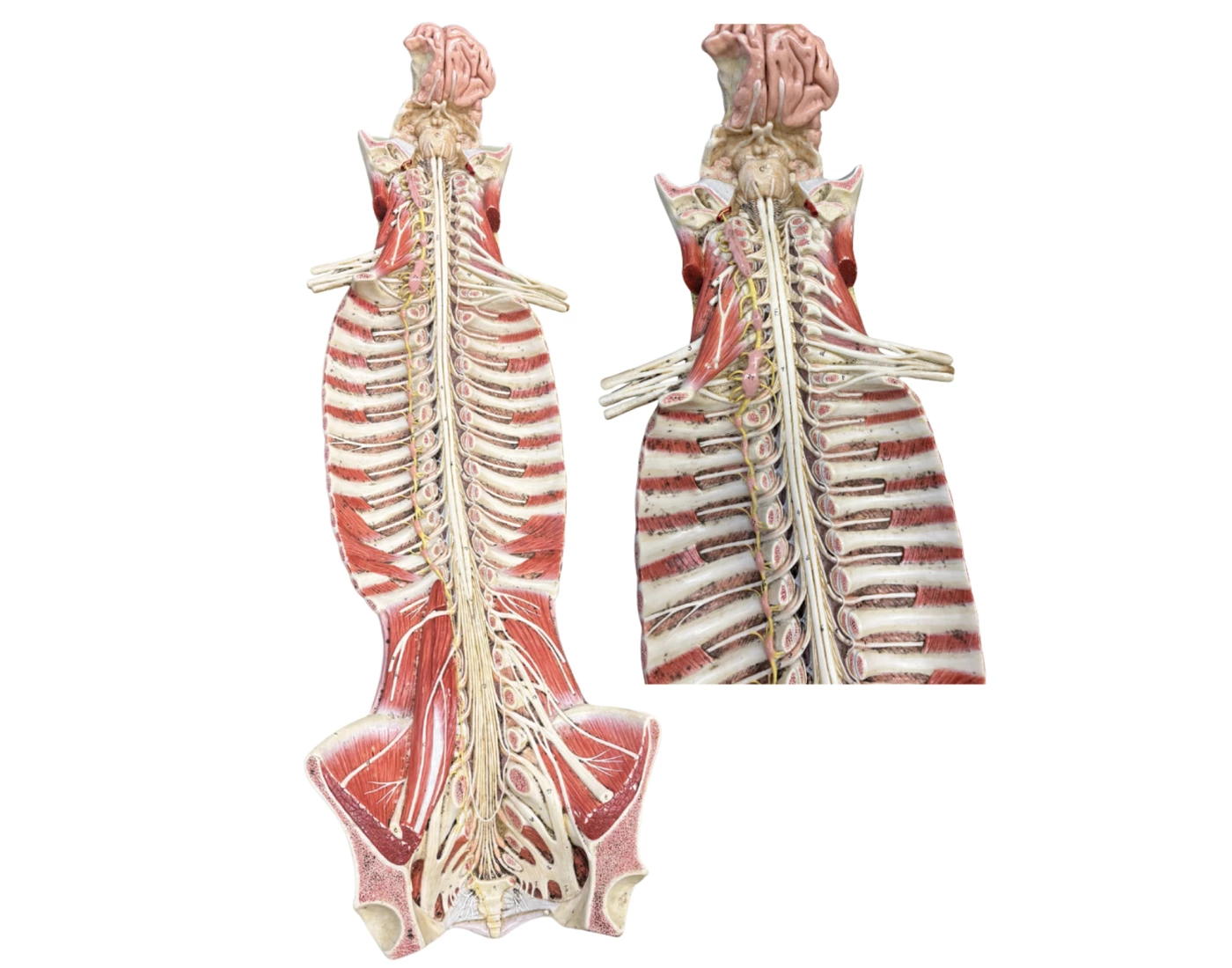 Rib Rack Labeled KL — Printable Worksheet