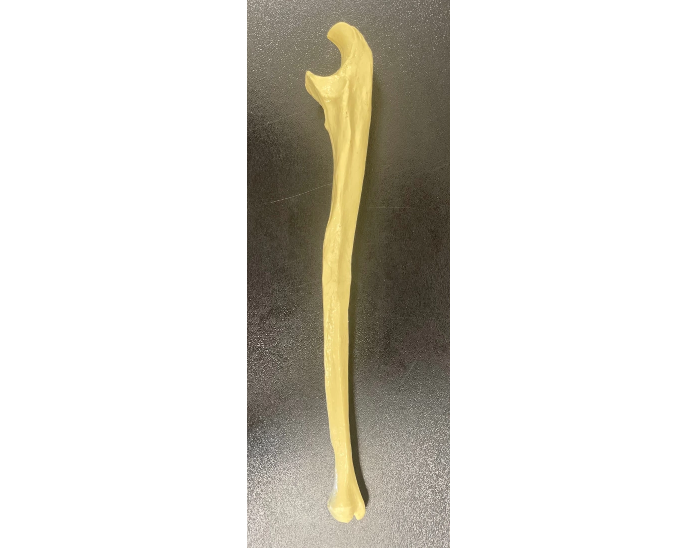 Ulna Features Printable Worksheet
