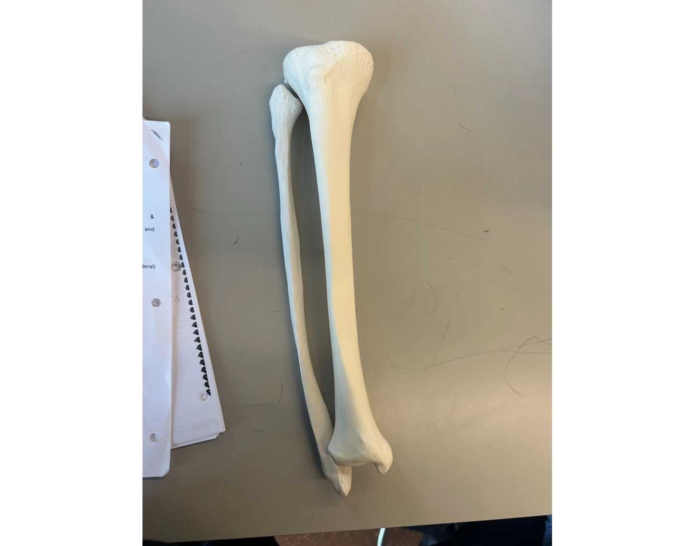tibia fibula anterior MWCC — Printable Worksheet