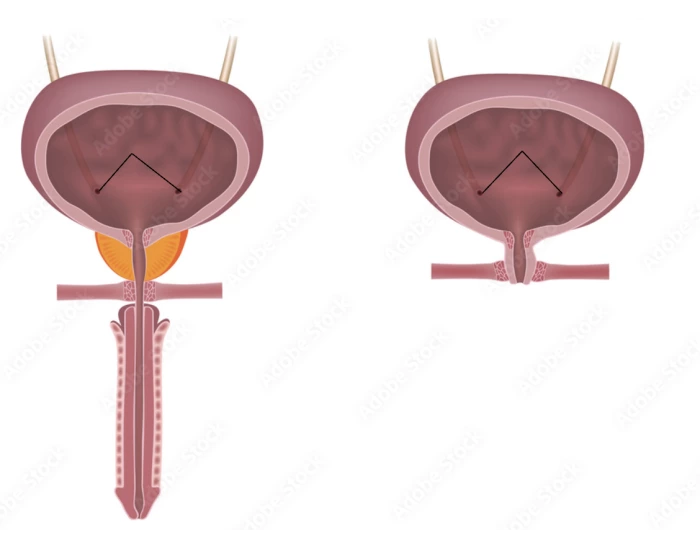 Bladder Game urinary bladders Quiz