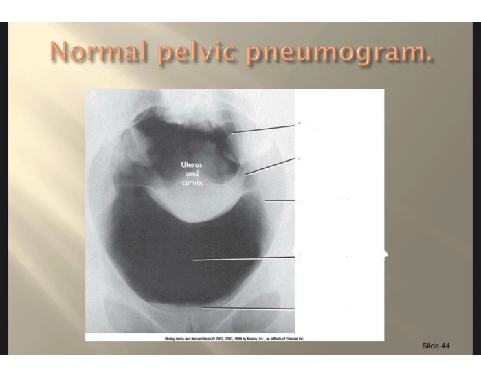 Normal Pelvic Pneumogram Printable Worksheet