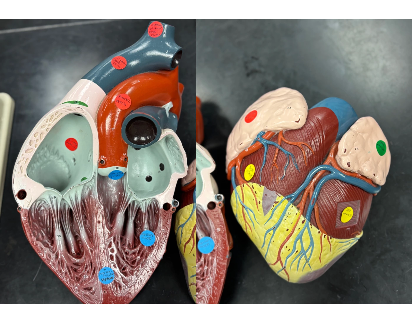 Heart Model Quiz