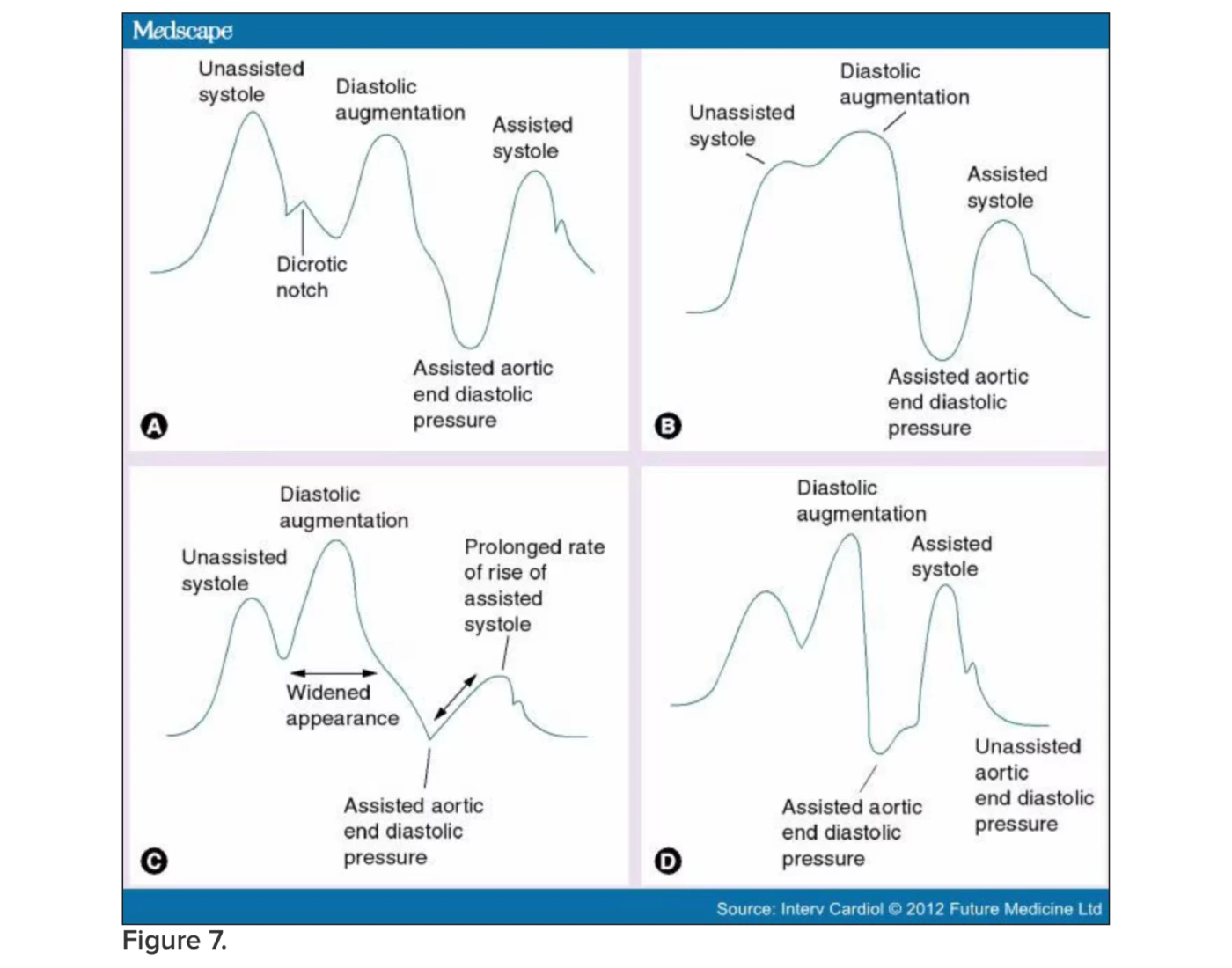 Common Errors Encountered During Intra Aortic Ball Printable Worksheet
