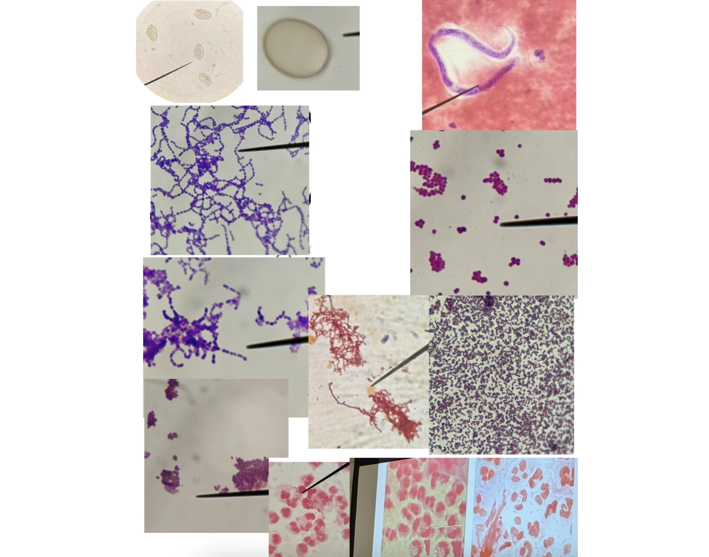 Microbe Test 1 Printable Worksheet