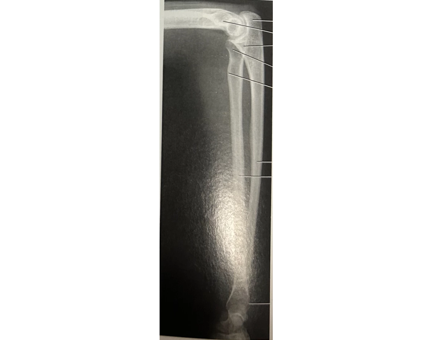 Lateral forearm X-ray Quiz