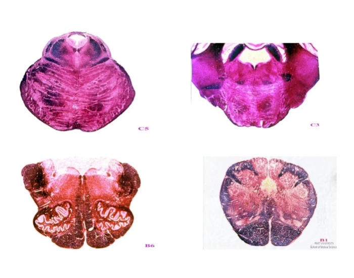 Brain Pyramids Cross-section of Brainstem — Printable Worksheet
