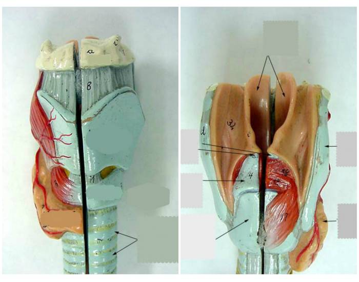 trachea model