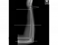 Radius and Ulna Xray Anatomical Parts Quiz