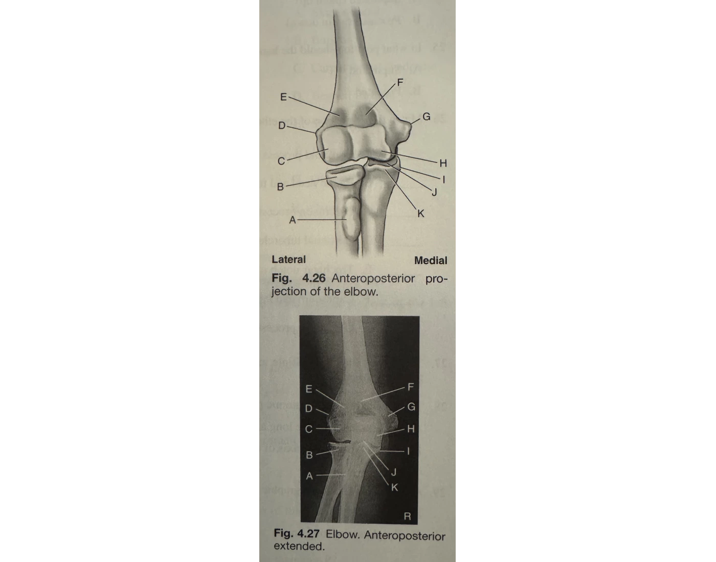 Ap Label AP elbow labeling quiz — Printable Worksheet