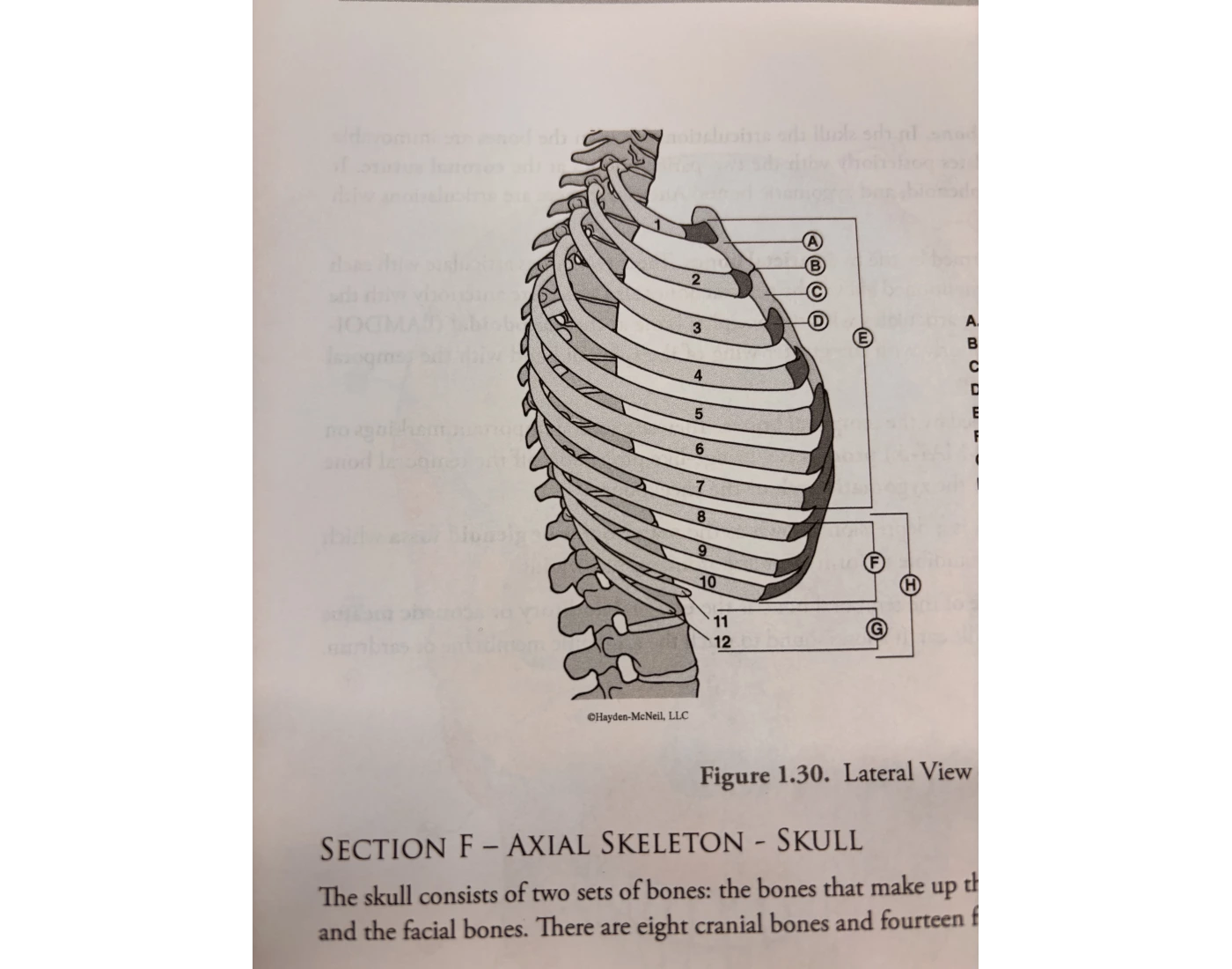 Lateral view of rib cage — Printable Worksheet