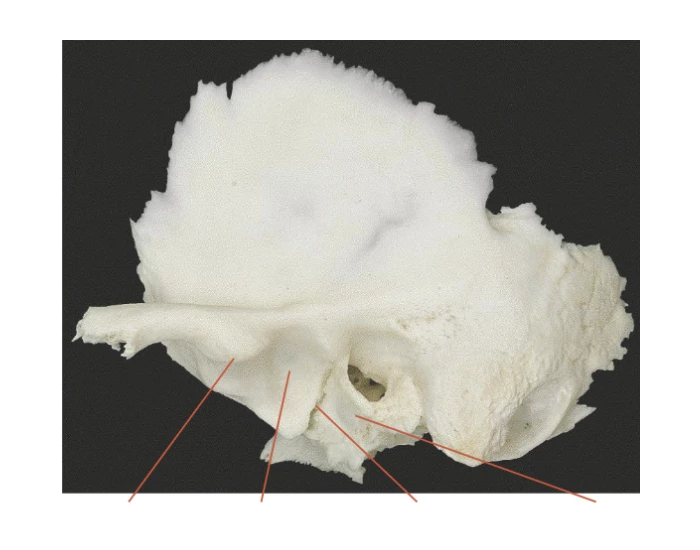 TMJ attachments on the temporal bone — Printable Worksheet