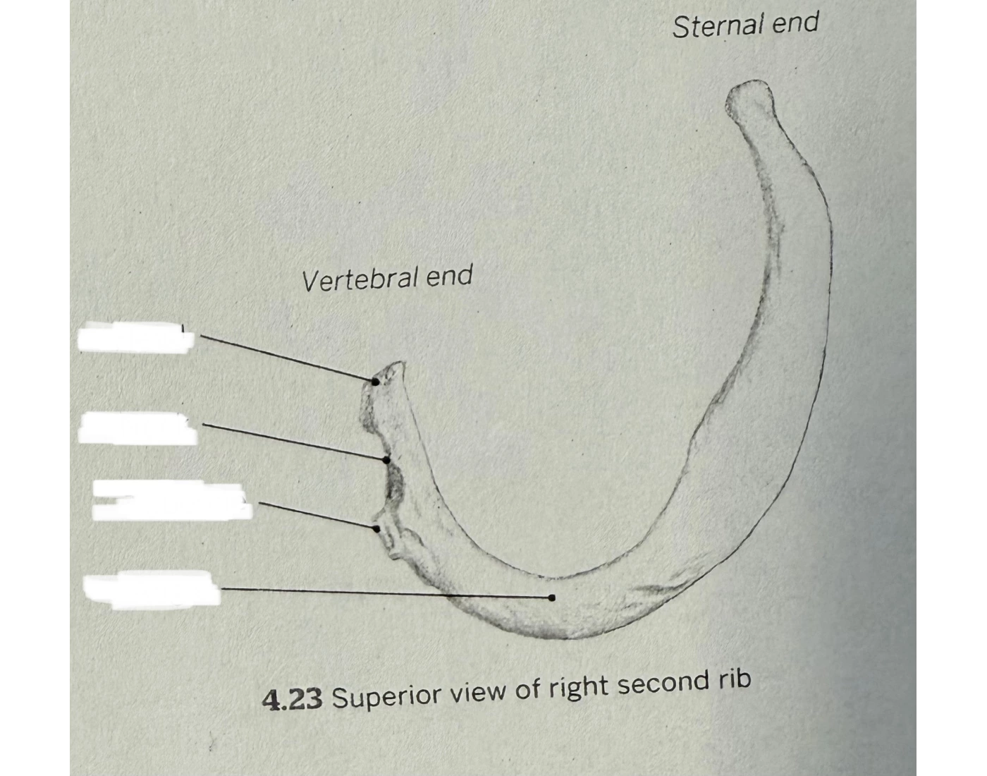 Superior view of right second rib Quiz