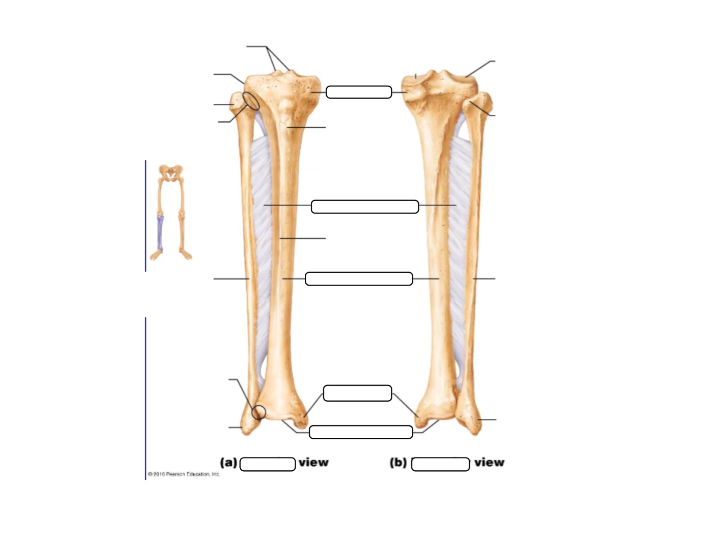 Tibia and Fibula Labeling — Printable Worksheet