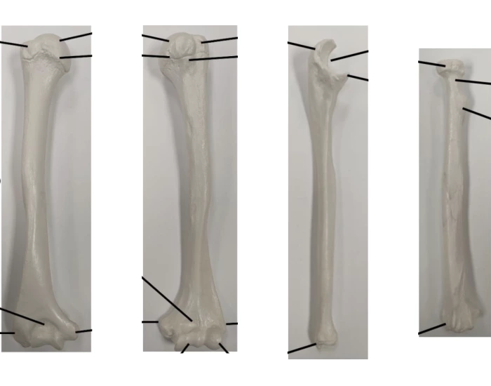 Humerus, Ulna, and Radius Quiz