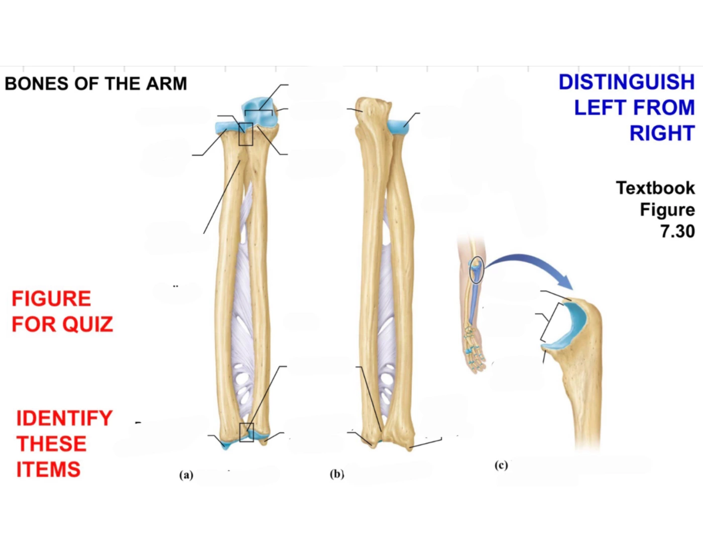 Radius and ulna Quiz