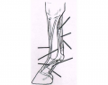 Tendons and Ligaments of the Horse's Lower Leg