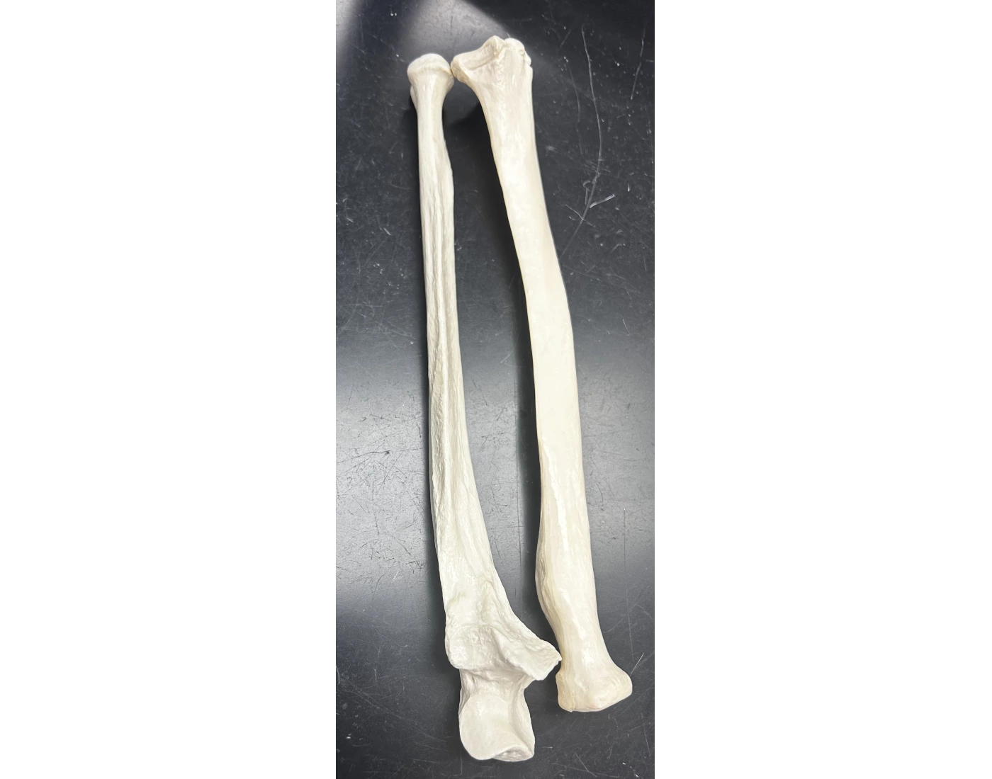 Radius & Ulna Quiz