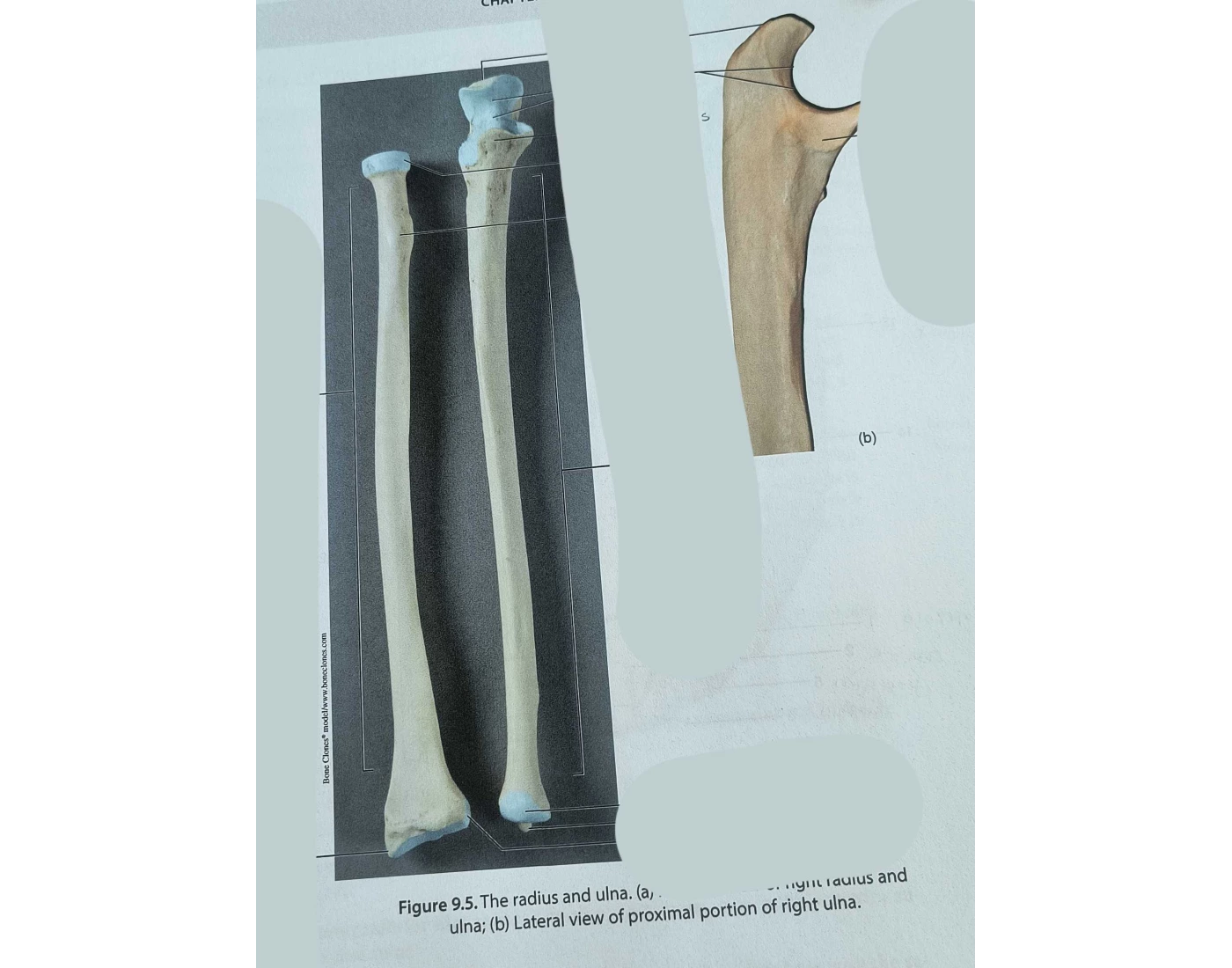 Anterior View of Right Radius and Ulna — Printable Worksheet