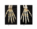 Bones of the Hand (Anterior/Posterior)