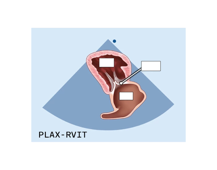 Plax Rvit With Color Parasternal Long Axis - RVIT — Printable Worksheet