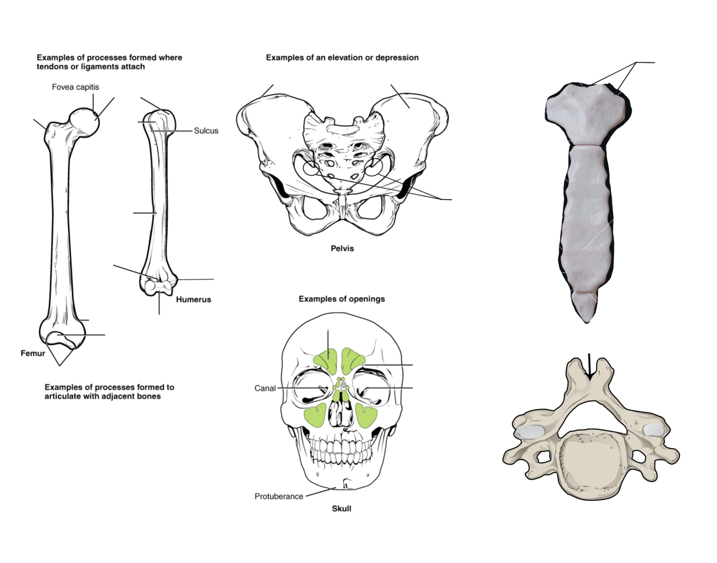Bones Project bone markings skeletal system project Quiz
