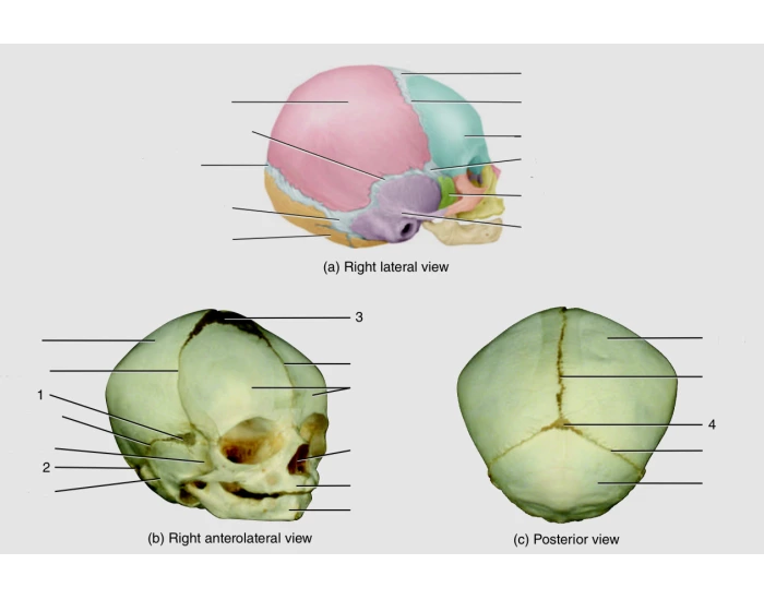 Labeling the fetal skull — Printable Worksheet