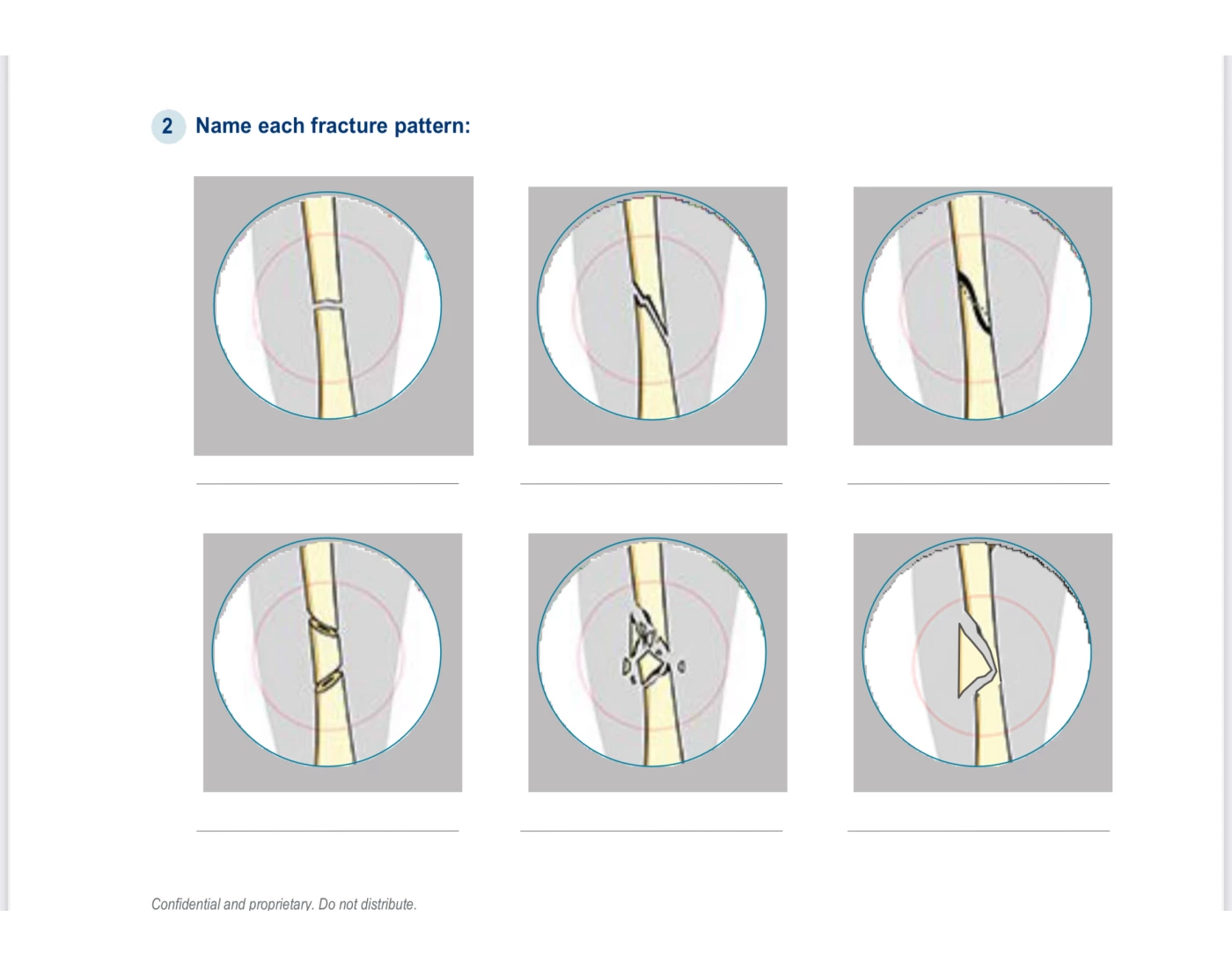 Machine Fracture Pattern Fracture Patterns Quiz