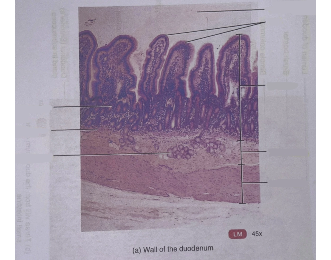 Wall of duodenum — Printable Worksheet